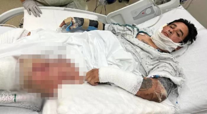 Write a new simple attractive title based on the title from Man hospitalized in San Antonio after being dragged 500 feet on street in Rio Grande Valley and dont use quote marks Write a new simple attractive title based on the title